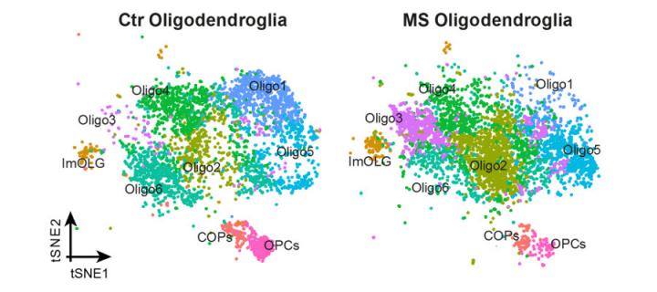 There are different types of oligodendrocyte in MS brains than normal brains