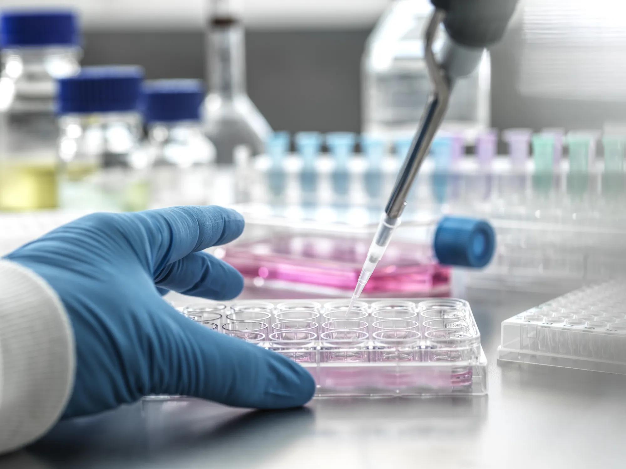 Scientist pipetting medical samples into a microplate in a laboratory