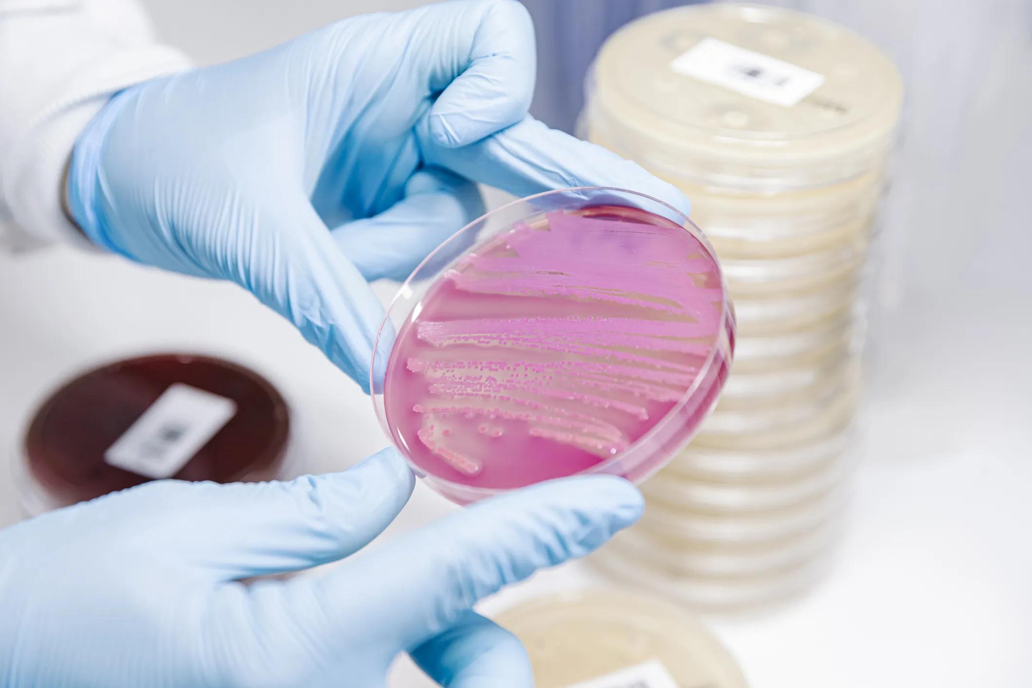 Scientist holding a petri dish with bacteria growing on it