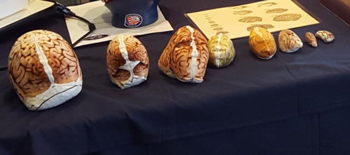 brain models arranged on a table