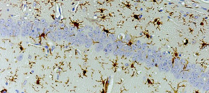 Activated microglia in brown intersected by a blue band of nerve cell nuclei