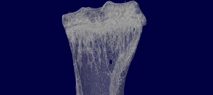 Bone imaging CGEM