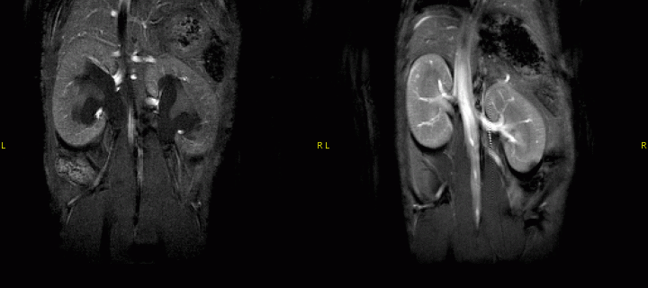 two images of the kidney