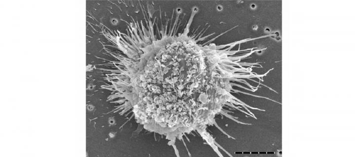 Image of dendritic cell spreadout
