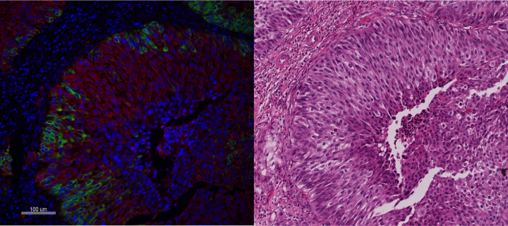 Mol Path Node comparative staining