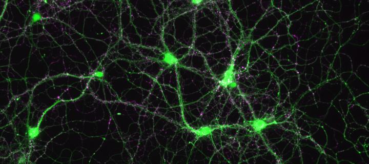 Hippocampal neurons