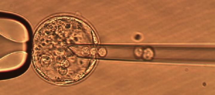 Embryonic Stem Cell Injection