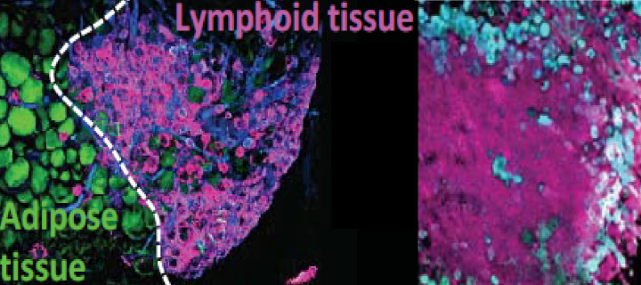 fat-associated lymphoid clusters