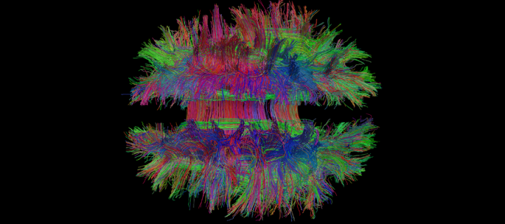 Brain scan