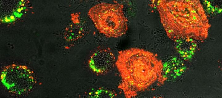 Image of LL37 treated infected cells