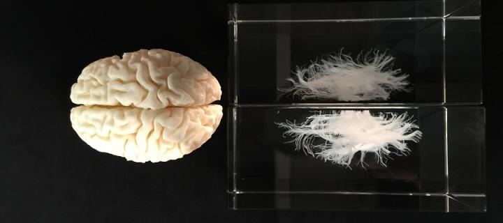 Digital image and etching of the brain of a participant in the Lothian Birth Cohort 1936 study.
