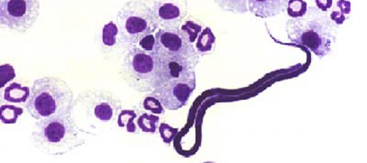 Micrograph of macrophages