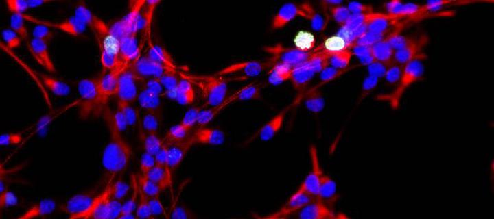 highly proliferative neural stem cells with cells in mitosis labelled in white. Nuclei in blue. Foxg1 and sox2 drive cell state