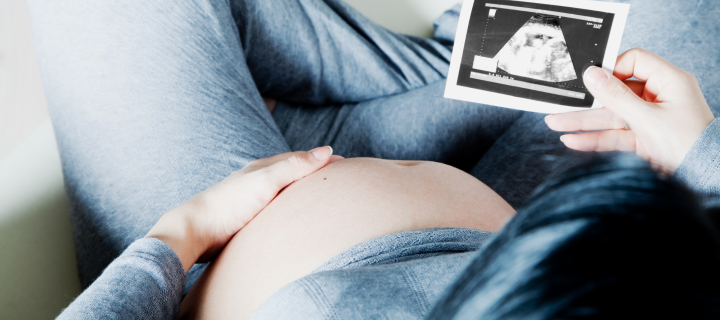 Pregnant women in grey tracksuit sat in chair holding photograph of scan