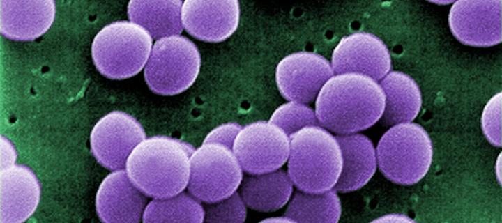 Electron micrograph of Staphylococcus aureus bacteria
