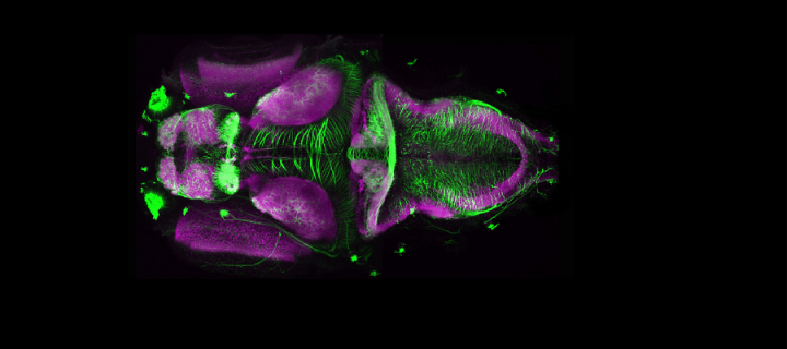 microscope image of a zebrafish brain