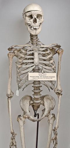 William Burke skeleton