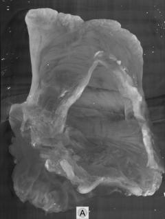 MicroCT image using iodine contrast, viewing through the mitral valve orifice into the left atrium.