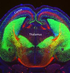 Mouse embryonic brain showing the thalamortical tract in red​