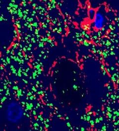Figure 1. GFAP-positive astrocytes (red) and synaptophysin (green) from human control tissue showing synaptic engulfment. Tissue processed by array tomography. 
