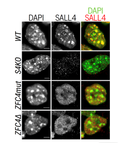 SALL4 binding to AT-rich heterochromatin depends on zinc finger cluster 4 (ZFC4)