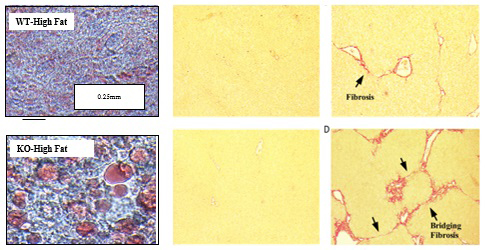 Combination of 6 images of WT-fat and KO-fat, showing fibrosis