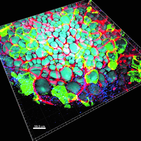 Red, green, and blue image of mesothelium differentiation