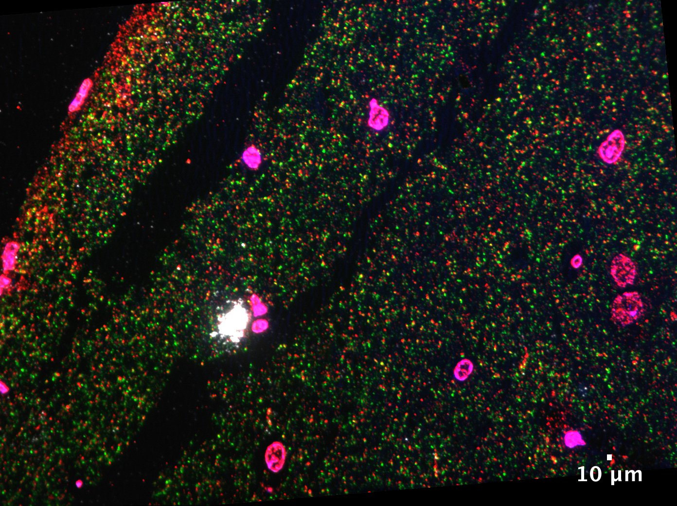 Figure 2. Hippocampal tissue from a mouse model of AD. Showing presynaptic protein synaptophysin (green) apposing postsynaptic P