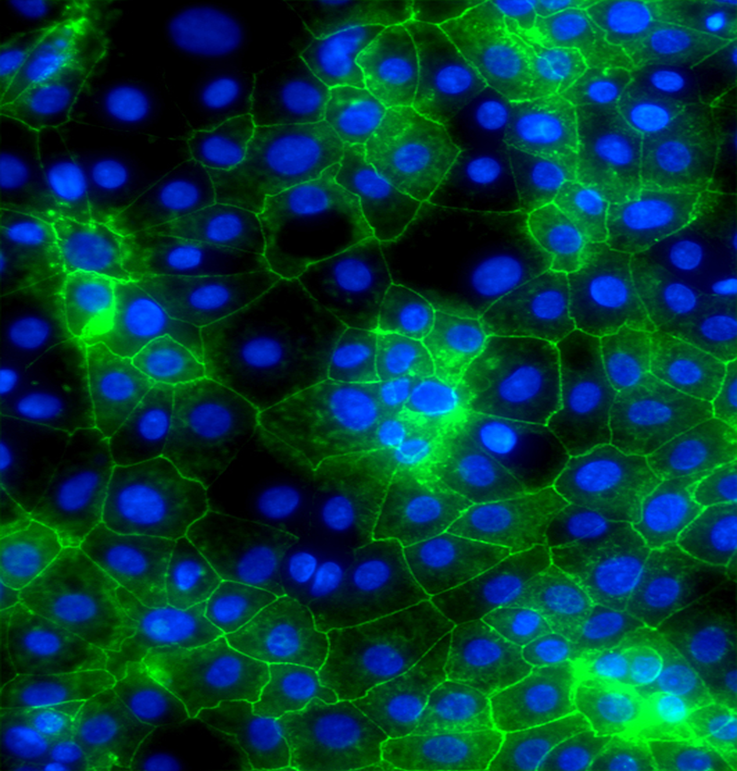 Stem cell derived hepatocyte like cells expressing E-Cadherin (green) and nuclei (blue)