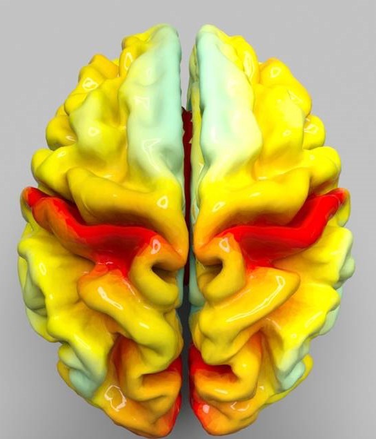 Image showing mean cortical thickness at age 79 