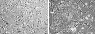 Human fibroblasts (left) reprogrammed into iPSCs (right).
