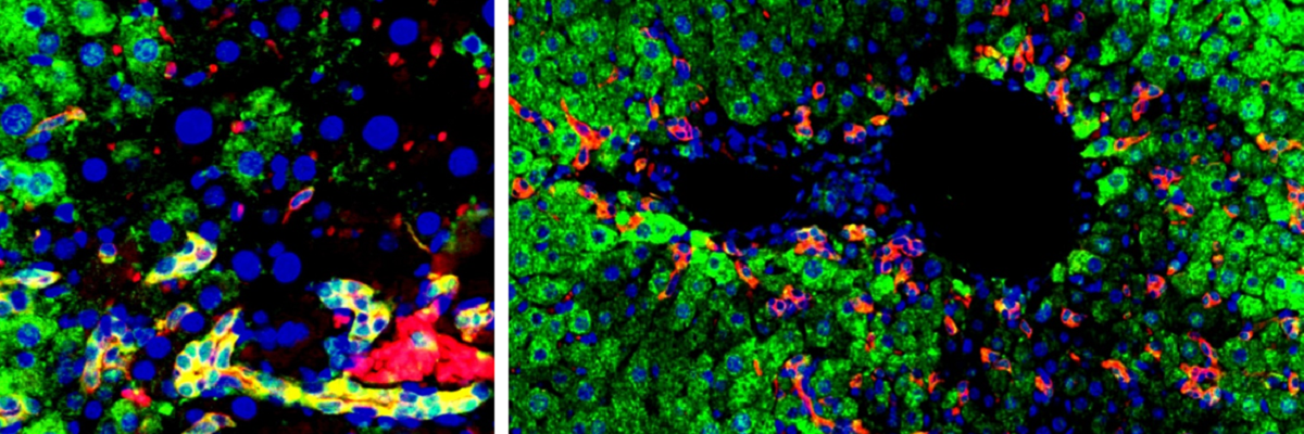Transplanted hepatic progenitor cells can self-renew (yellow, left image) and differentiate into hepatocytes (green) to repair t
