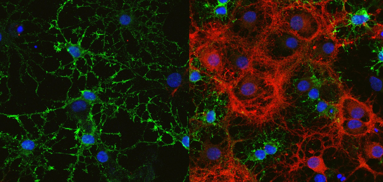 Oligodendrocytes start making myelin