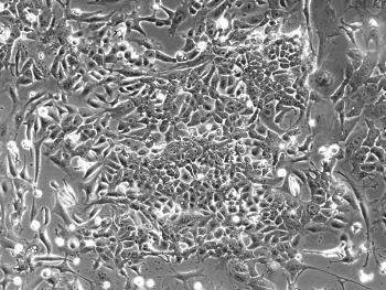 Fibroblasts becoming induced pluripotent stem cells